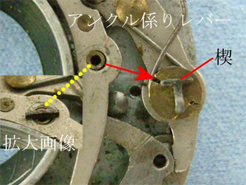 アンクル係りレバーを外す・１